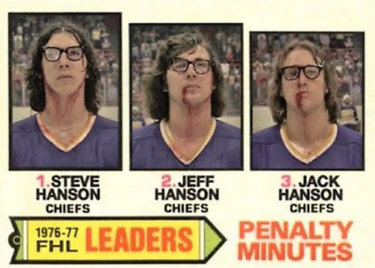 Three identical vintage hockey trading cards show the same man with long hair and glasses, each with a different name…