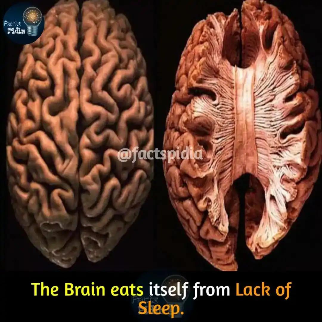 The image displays two side-by-side views of a human brain: the left shows the outer surface with folds, and the right shows…