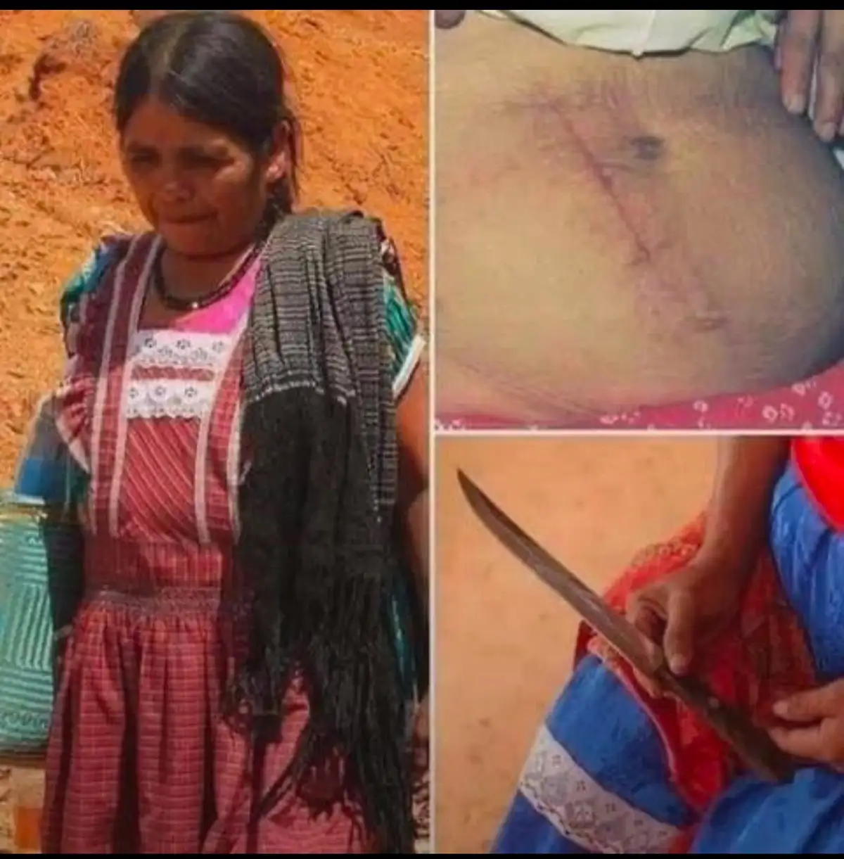 A three-panel image collage shows a woman in traditional clothing crying, a close-up of a scar on a person's stomach, and a…