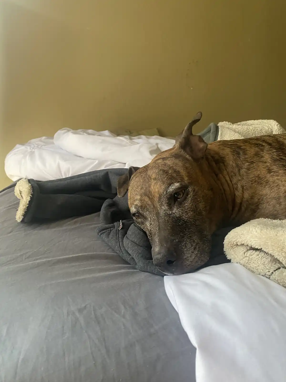 A brindle-coated dog with a weary expression rests its head on a dark grey hoodie on a bed with grey and white bedding. The…