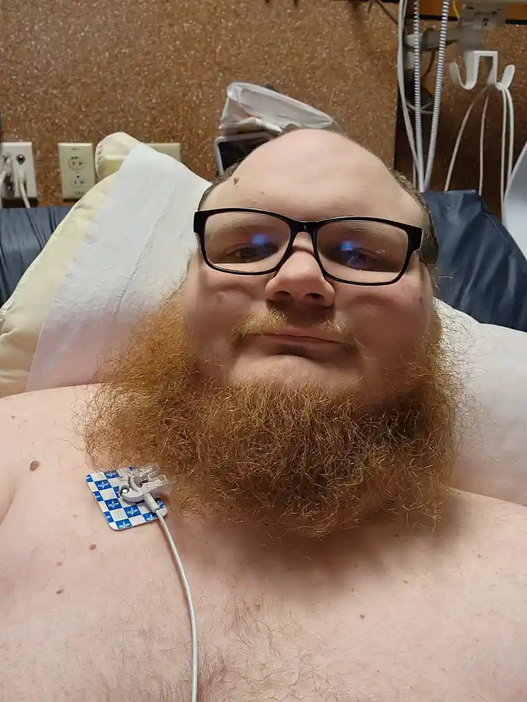 A man with a thick reddish beard and black-rimmed glasses lies shirtless in a hospital bed, looking at the camera with a…