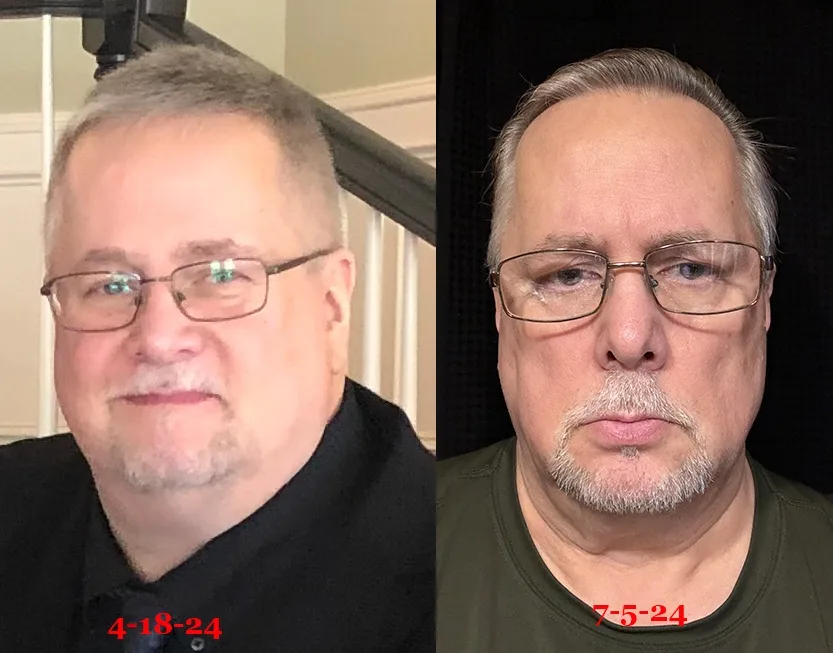 Two side-by-side photos of the same man with glasses and a goatee, showing him looking noticeably thinner and more gaunt in…