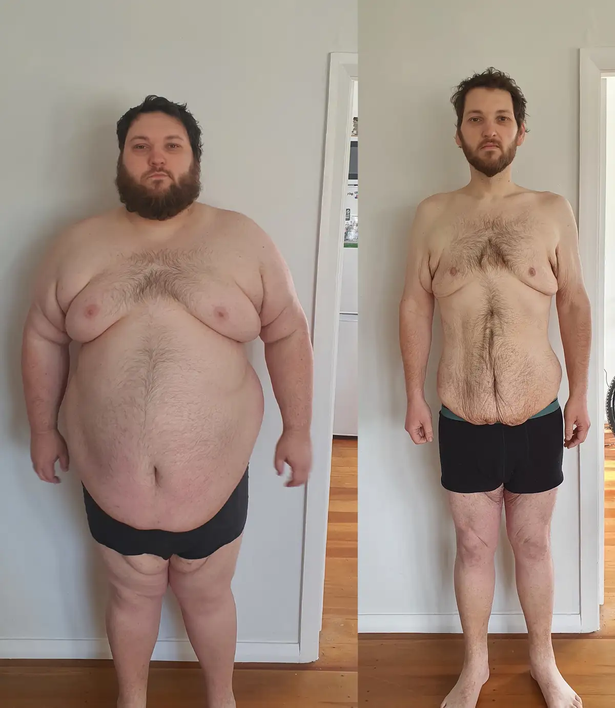 A side-by-side comparison shows a man in two states: on the left, he is significantly overweight with a large belly and…