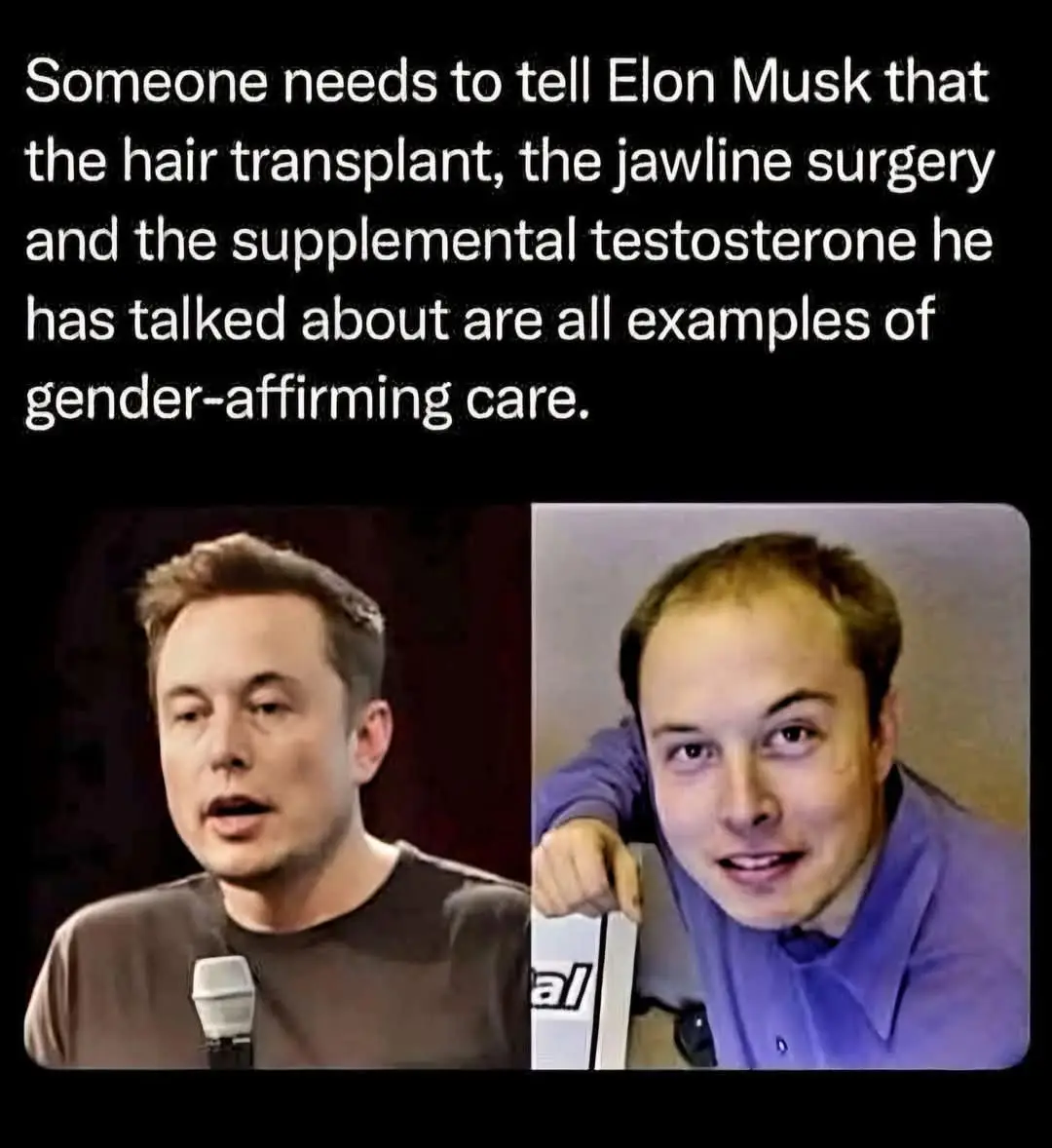 The image displays two side-by-side photos of Elon Musk: one showing him with a fuller head of hair speaking into a…