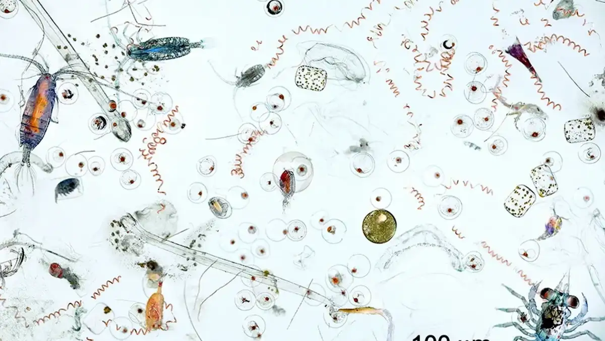 A microscopic image showing a dense field of tiny aquatic organisms including copepods, rotifers, and protozoans, with a…