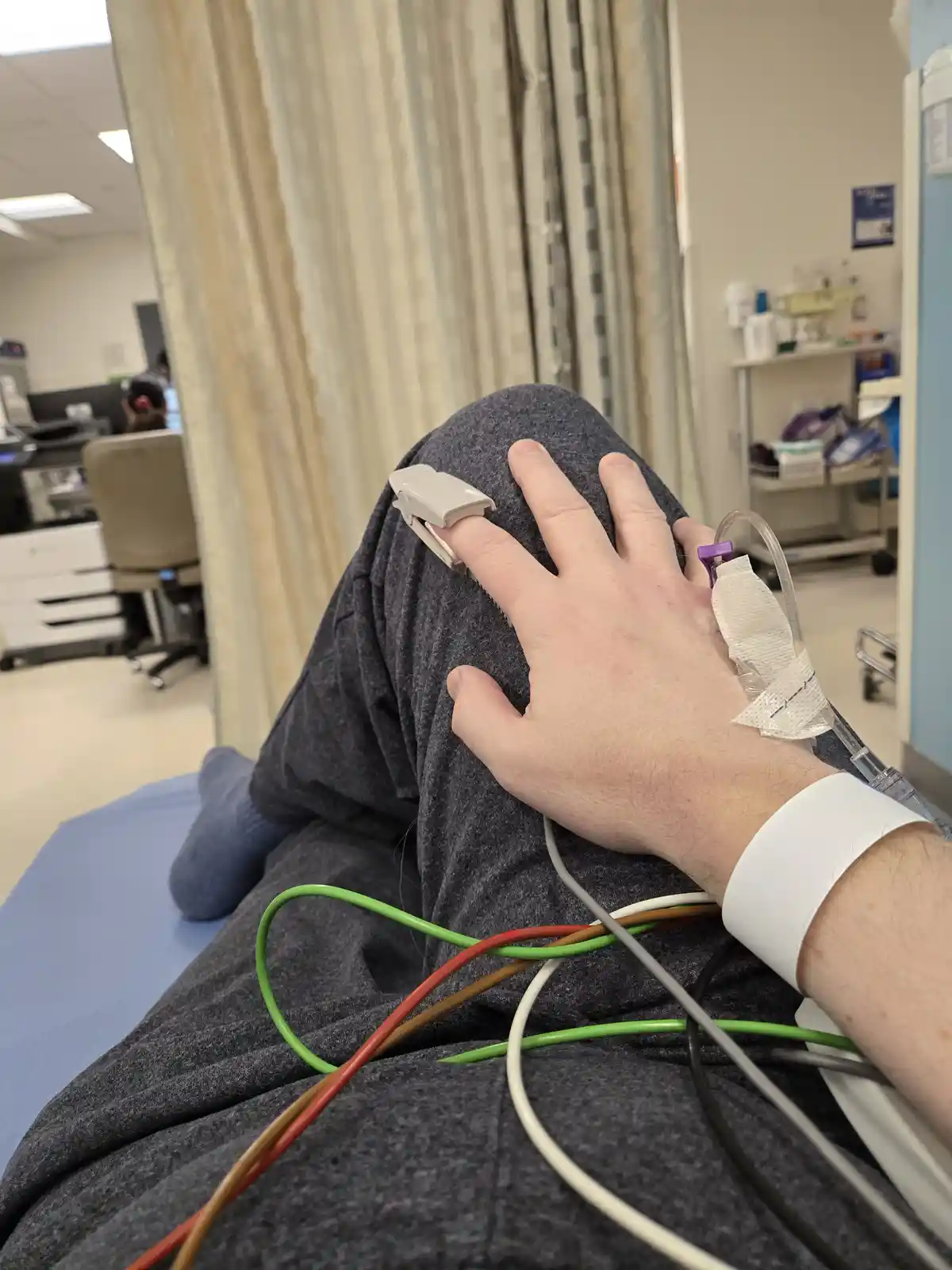 A person is lying on a hospital bed with medical equipment attached to their hand and leg, including an IV line, a pulse…