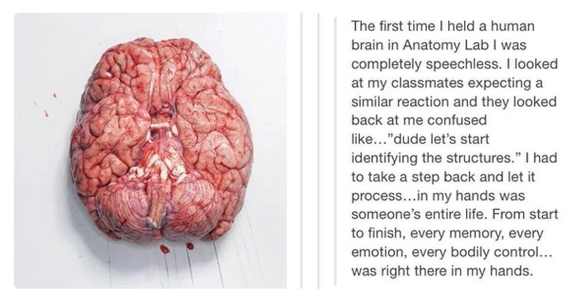 An image of a human brain on a white surface, next to a block of text describing a student's emotional reaction during an…