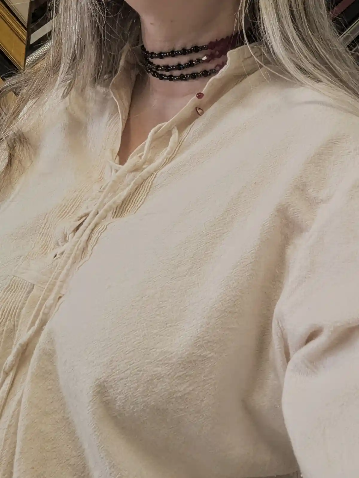 A Close Encounter: Bitten!