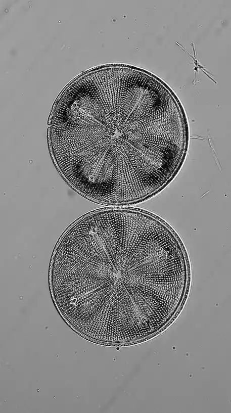 A black-and-white microscopic image shows two identical, circular, patterned organisms stacked vertically, resembling halves…