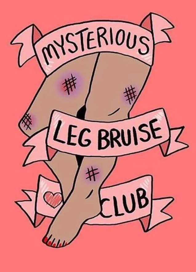 An illustrated leg with purple bruises marked by hashtag symbols, wrapped in pink banners reading 'MYSTERIOUS', 'LEG…