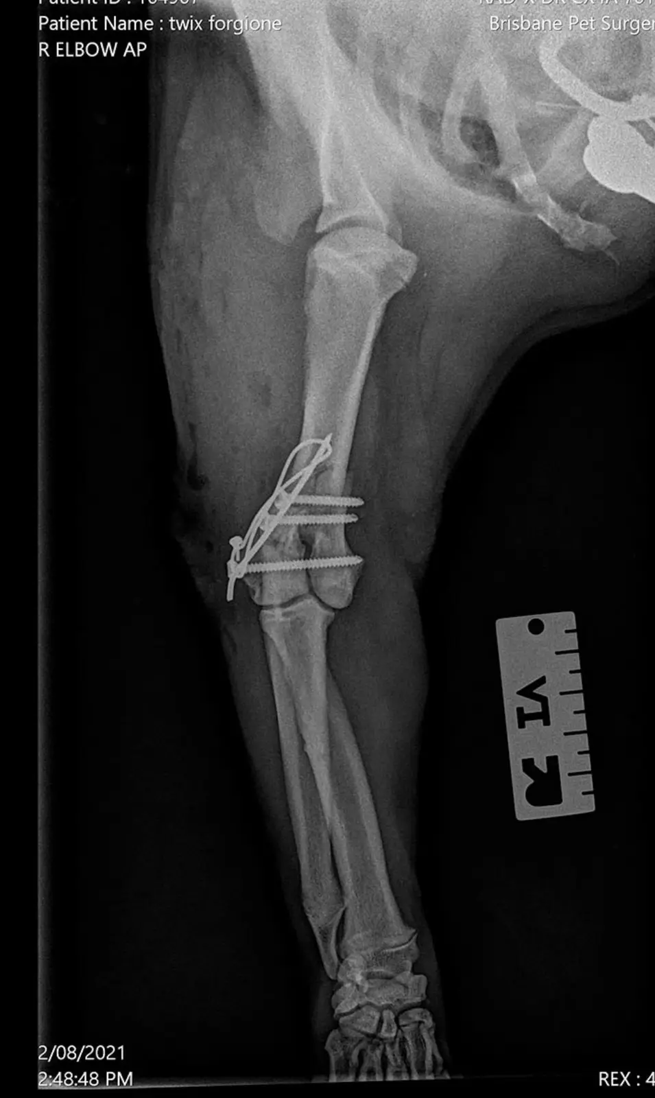 An x-ray image of a dog's right front leg showing a surgical fixation with screws and a plate at the elbow joint. The image…