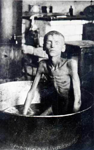 A black-and-white historical photograph shows a severely malnourished child, ribs and bones visible, sitting in a large…