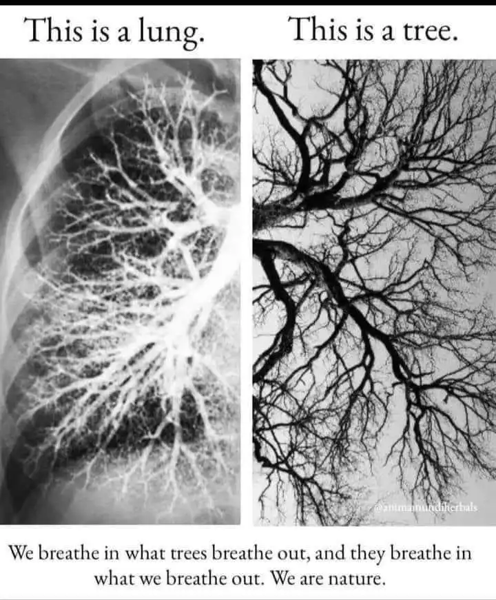 The image displays two side-by-side black-and-white photos: the left shows an x-ray of a human lung with branching bronchi…