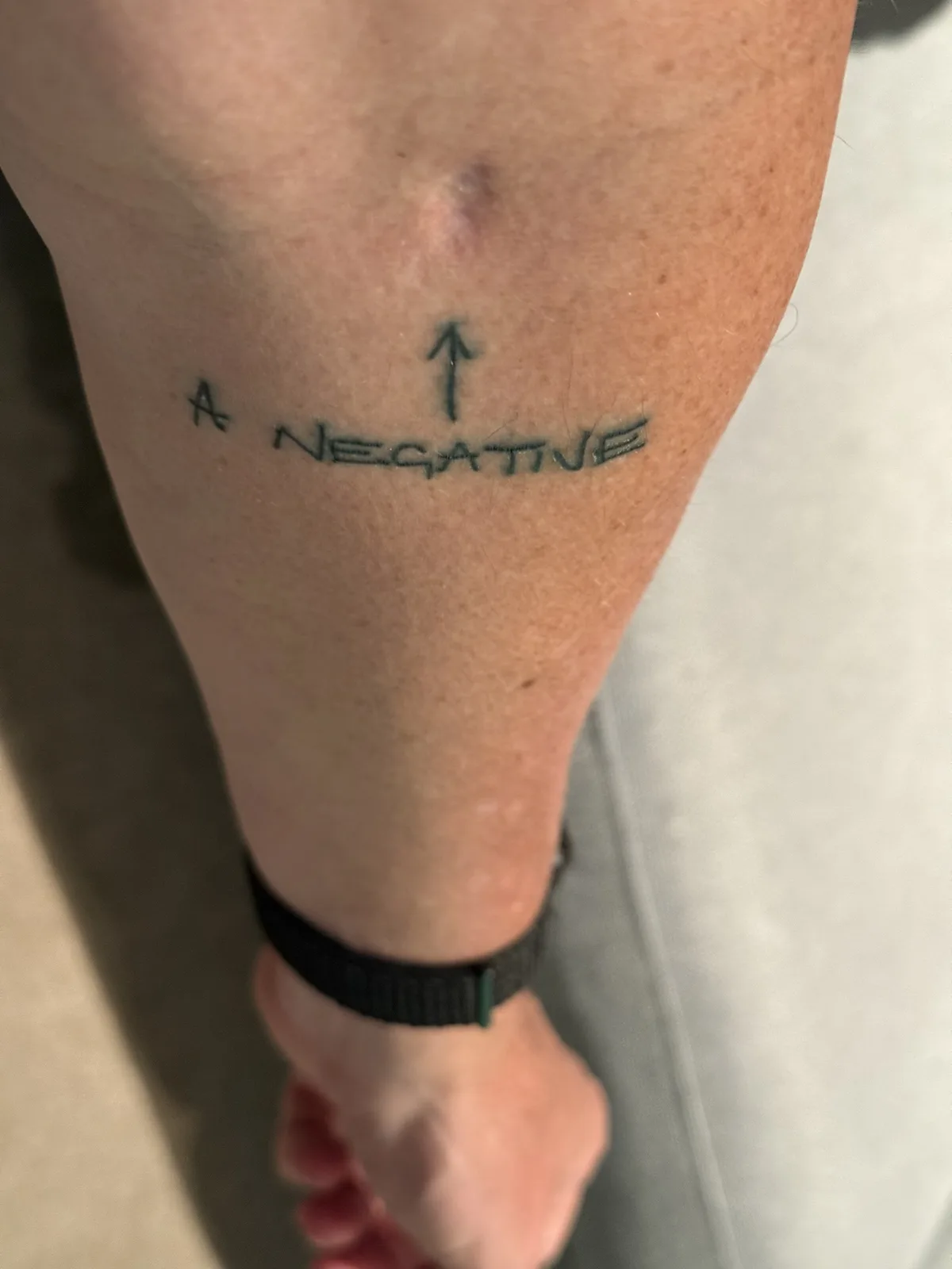A close-up photo shows a tattoo on a person's forearm that reads 'A NEGATIVE' with an arrow pointing upward above the word…