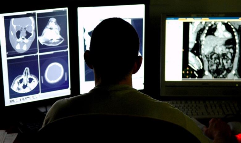 A person viewed from behind sits in front of three computer monitors displaying medical CT scans of a human torso and head…