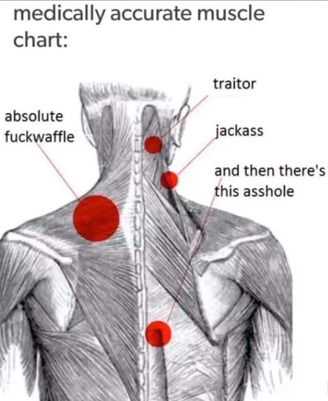 A black-and-white anatomical drawing of a human upper back and neck with red circles highlighting muscle groups. Text labels…