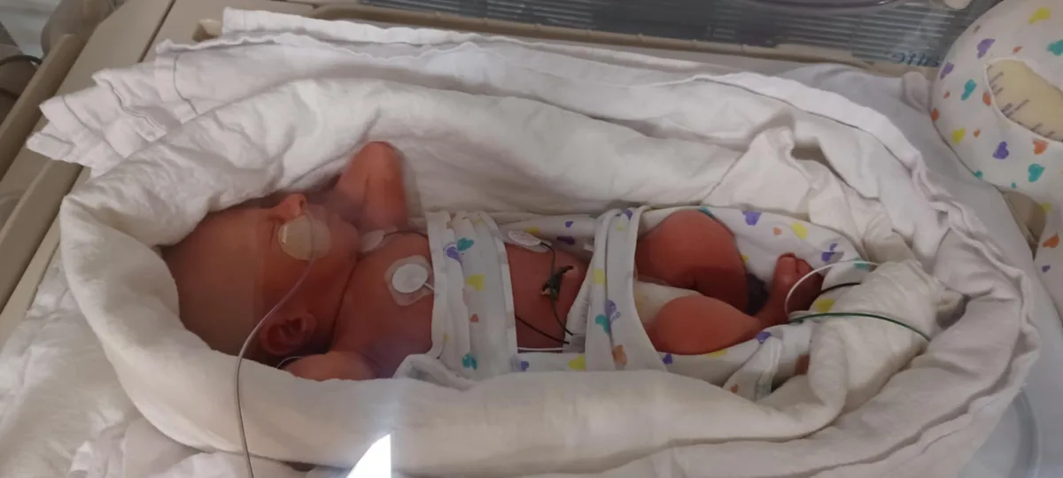 A newborn baby lies in a hospital bassinet, wrapped in a white blanket with colorful heart patterns, connected to medical…