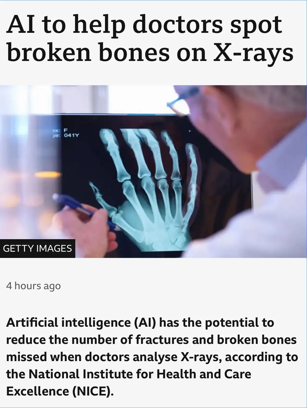 An image shows a doctor examining an X-ray of a hand on a screen, holding a pen as if marking something. The overlaid text…