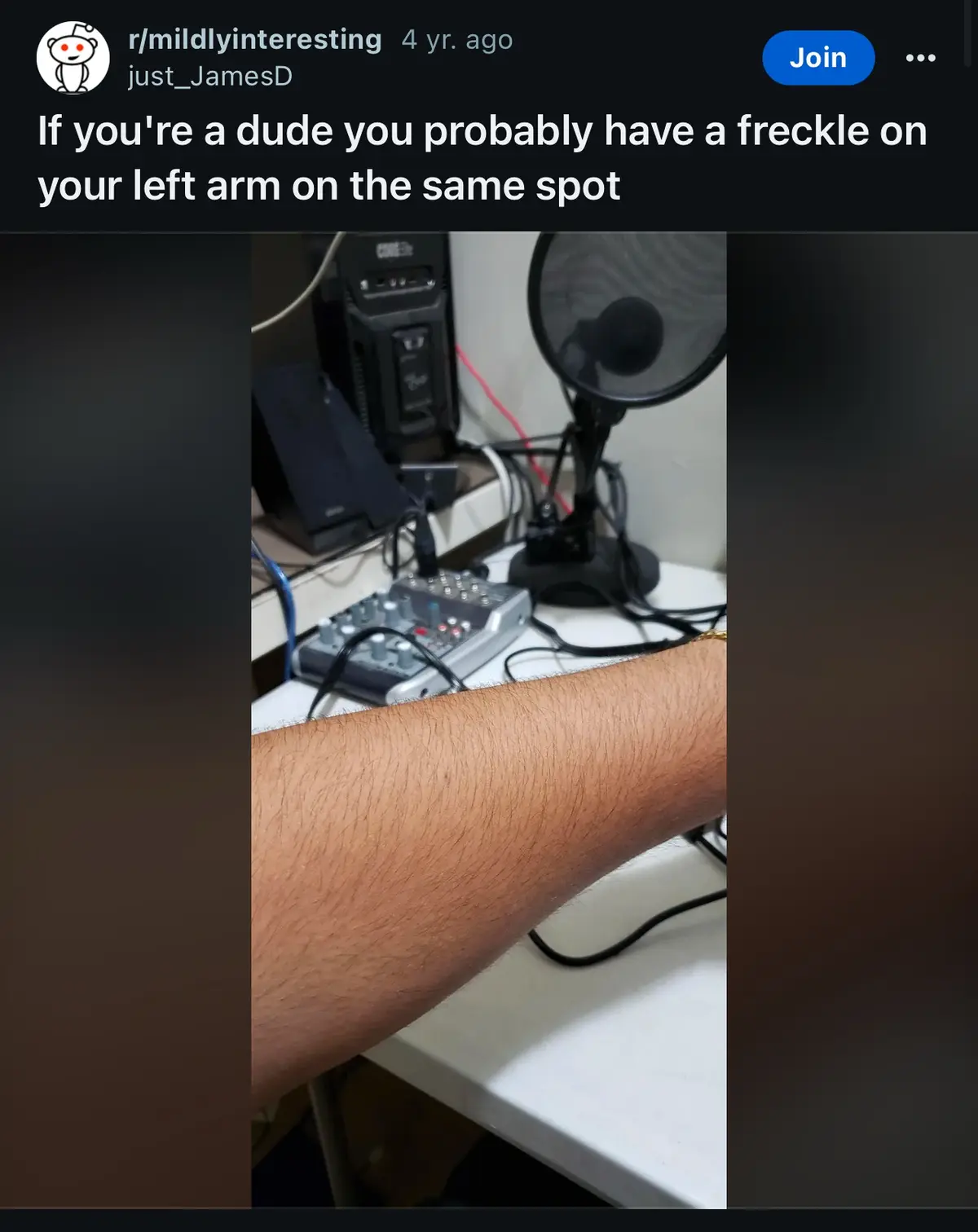 A close-up photo shows a hairy left forearm resting on a white desk, with audio equipment and a microphone in the…