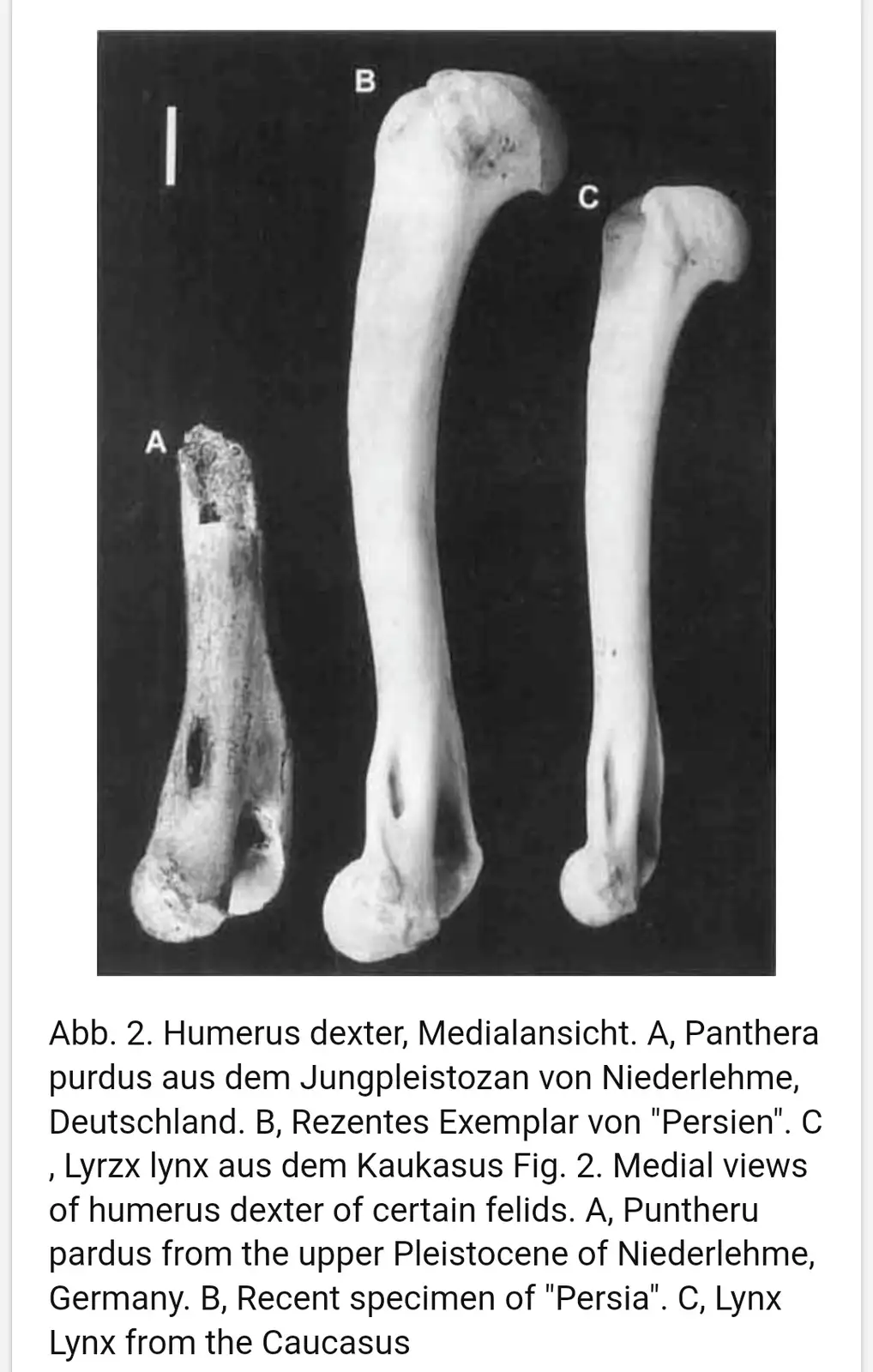 The image displays three human-like bones labeled A, B, and C, arranged vertically against a black background. The overlaid…