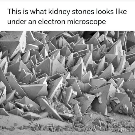 A black-and-white electron microscope image shows a dense, jagged landscape of sharp, triangular crystalline structures…
