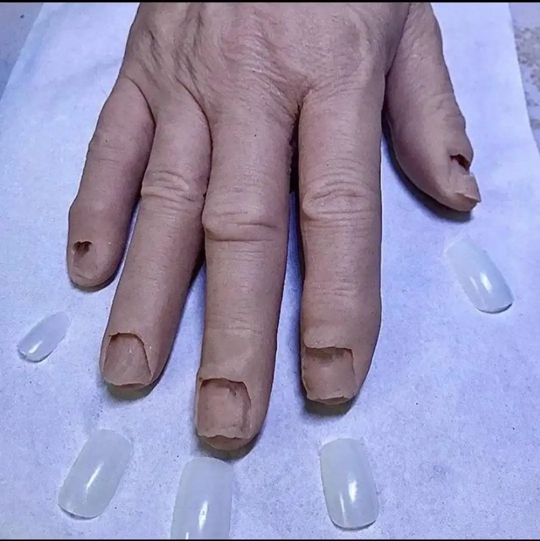 A close-up photo shows an adult's hand with severely short, broken, and ragged fingernails. Several clear, artificial…