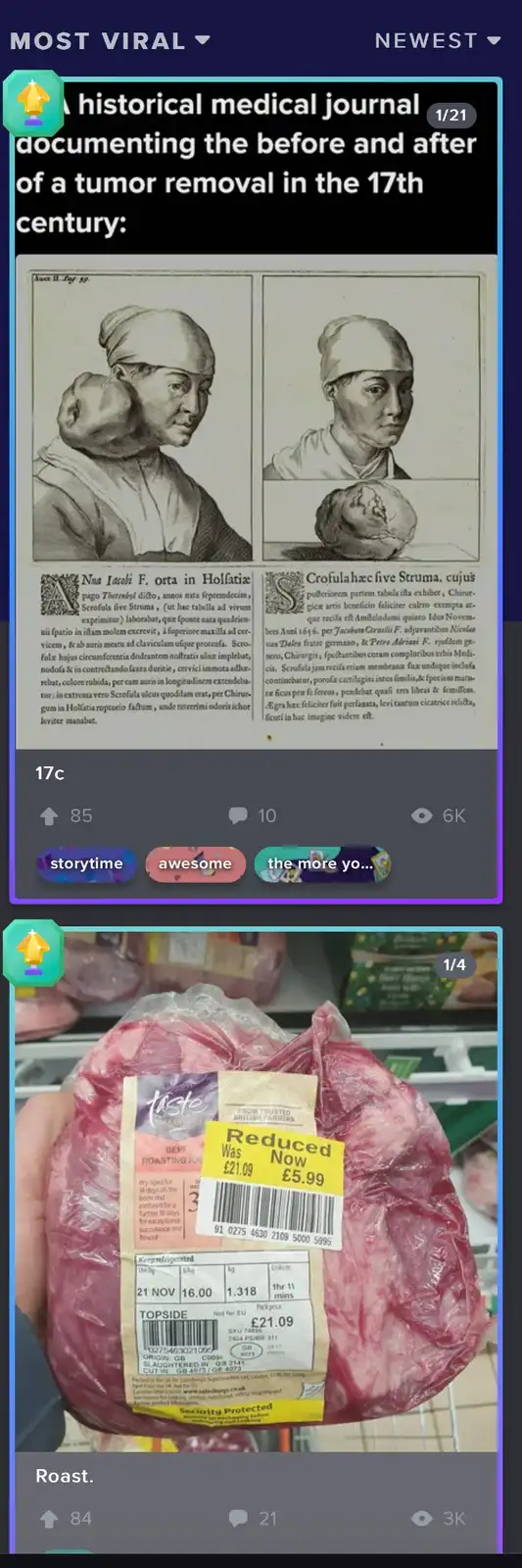 The image displays a meme comparing a 17th-century medical journal illustration showing a tumor removal to a modern photo of…
